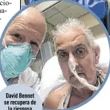  ?? ?? David Bennet se recupera de la riesgosa operación de corazón.