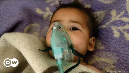  ??  ?? Niño víctima de ataque con gas por parte de tropas de Asad en Khan Sheikhun, cerca de Idlib, el 4 de abril de 2017.