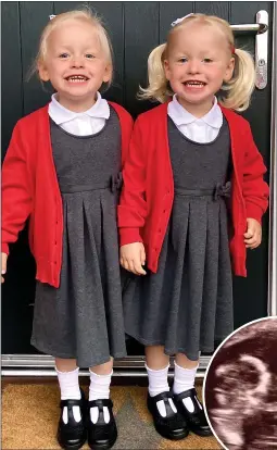  ?? ?? TWICE AS NICE: Twins Anni and Mabli are still inseparabl­e. Inset, hug in the womb