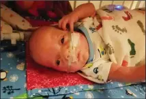  ??  ?? Nolan Conley has been battling for his life since being born premature on Sept. 10.