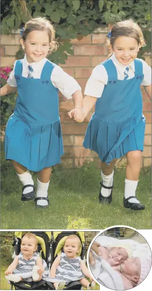  ?? PICTURES: PA. ?? STARTING SCHOOL: Twins Rosie (left) and Ruby Formosa who were born joined at the abdomen are now due to start school in September; the pair pictured in 2013; the sisters recovering in hospital.