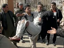  ?? PHOTO: AP ?? A wounded man is assisted at the site of a deadly suicide attack in the centre of Kabul last month.