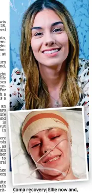  ??  ?? Coma recovery: Ellie now and, inset, after her brain surgery