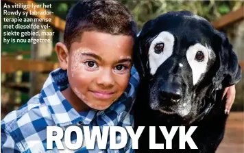  ??  ?? As vitiligo-lyer het Rowdy sy labradorte­rapie aan mense met dieselfde velsiekte gebied, maar hy is nou afgetree.