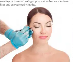  ??  ?? Thermage is commonly combined with Botox or dermal fillers for better results.