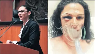  ??  ?? ANTES Y DESPUÉS. Ana Guevara, actualment­e senadora, mostró su rostro herido en Twitter.