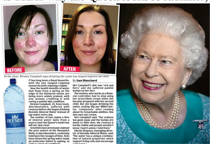  ??  ?? In the clear: Kirsten Campbell says drinking the water has helped improve her skin In the know? The Queen is said to enjoy a glass of Deeside Mineral Water BEFORE AFTER