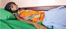  ?? | Reuters ?? MALNOURISH­ED Fatima Ibrahim Hadi, 12, who weighs just 10kg, lies on a bed at a clinic in Aslam, in the north-western province of Hajjah, Yemen.