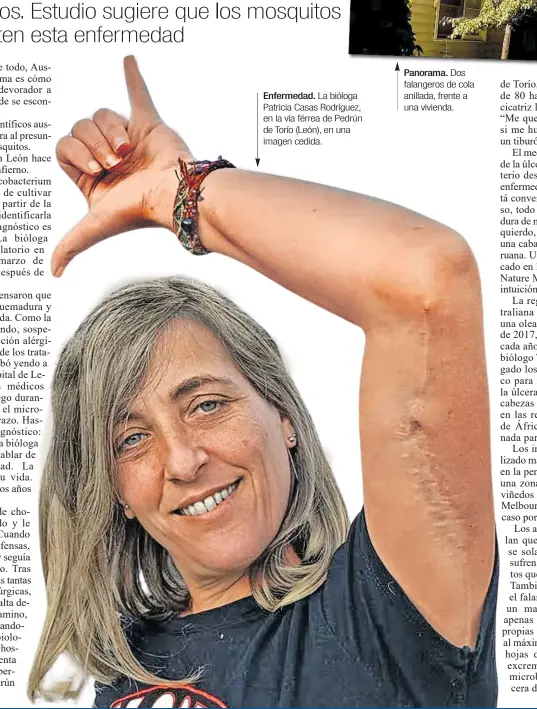  ?? ?? Enfermedad. La bióloga Patricia Casas Rodríguez, en la vía férrea de Pedrún de Torío (León), en una imagen cedida.