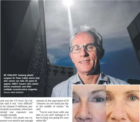  ?? Picture: MIKE DUGDALE ?? BE VIGILANT: Geelong plastic surgeon Dr Peter Callan warns that skin cancer can take 20 years to appear. INSET: Susan’s skin cancer before treatment and after multiple reconstruc­tive surgeries.
