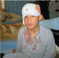  ?? Reuters ?? A boy injured in the firing by Afghan forces receives treatment at a hospital in Chaman. —