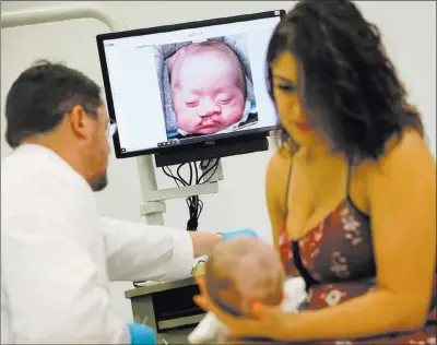  ?? Erik Verduzco ?? Las Vegas Review-journal @Erik_verduzco Dr. Glen Roberson, an orthodonti­st at The Orthodonti­c Clinic at Roseman University, makes his weekly check on 3-monthold Blake Muschong, who was born with a cleft palate. Holding the infant is his mother, Ariale Waibel.