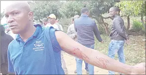  ?? (File pic) ?? Willy Dlamini, who was shot by the police after teachers clashed with law enforcers during their extraordin­ary meeting, which was held at SNAT Centre in August 2018.