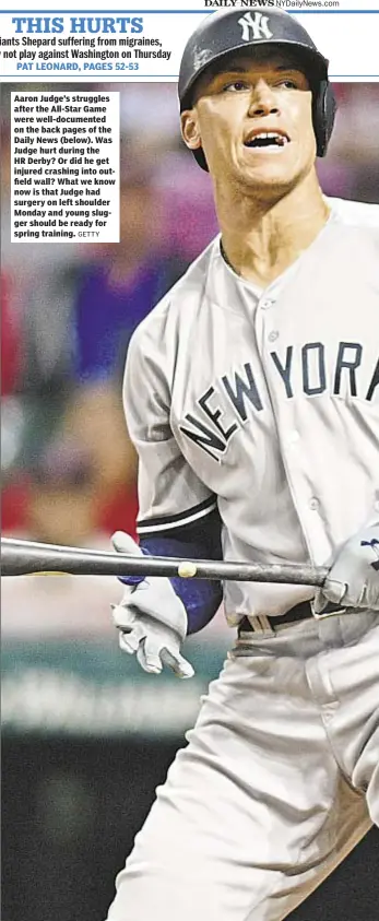  ?? GETTY ?? Aaron Judge’s struggles after the All-Star Game were well-documented on the back pages of the Daily News (below). Was Judge hurt during the HR Derby? Or did he get injured crashing into outfield wall? What we know now is that Judge had surgery on left...