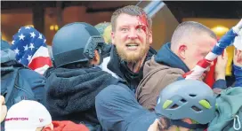  ??  ?? A rioter with a head injury while trying to push past police through the doorway of the