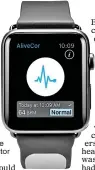  ??  ?? ALERT: An Apple Watch heart monitor