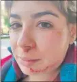  ?? ?? Heridas de Sheyla Gutiérrez.