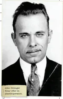  ??  ?? John Dillinger flinar efter en plastikope­ration.