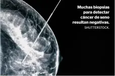  ?? SHUTTERSTO­CK. ?? Muchas biopsias para detectar cáncer de seno resultan negativas.