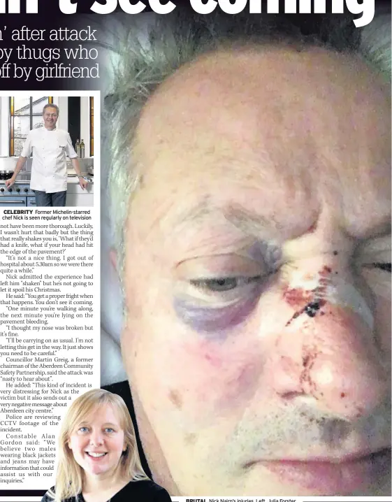  ??  ?? CELEBRITY Former Michelin-starred chef Nick is seen regularly on television BRUTAL Nick Nairn’s injuries. Left, Julia Forster