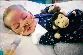  ?? CONTRIBUTE­D ?? ABOVE: 11-monthold Charlie Gard has a rare genetic disease called mitochondr­ial DNA depletion syndrome.