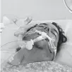  ??  ?? John Place breathes through a ventilator while fighting COVID-19 in an ICU bed at Westside Regional Medical Center in Plantation.