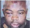  ?? FILE PHOTO ?? Orlando Bowen, beaten severely by two police officers in 2004, now works with the Ontario Police College.