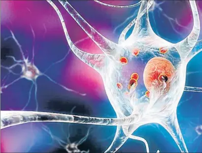  ??  ?? La sinucleïna anòmala es propaga de neurona a neurona i causa parkinson o demència de cossos de Lewy