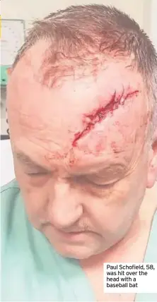  ??  ?? Paul Schofield, 58, was hit over the head with a baseball bat