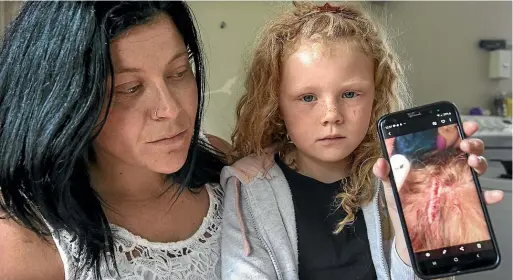  ?? JOHN BISSET/STUFF ?? Kat Beckett shows a photo of the laceration on 6-year-old daughter Aleka’s scalp after an unprovoked dog attack at a neighbour’s property in Timaru on Tuesday.