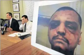  ?? Allen J. Schaben
Los Angeles Times ?? GABRIEL CARRILLO, at center, listens to attorney Ronald Kaye. A photo at right shows injuries inf licted by deputies, who claimed he went on the attack.