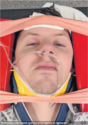  ??  ?? Professor Green shared a picture of his injuries on Instagram