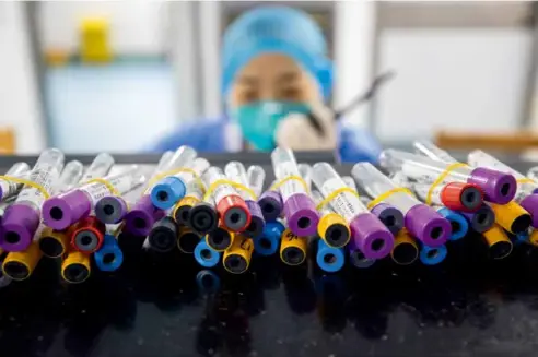  ?? 摄影 柯皓/湖北日报 ?? 2020年1月26日，武汉金银潭医院隔离病­区，护士面前摆放着为患者­准备好的采血管。