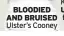  ??  ?? BLOODIED AND BRUISED Ulster’s Cooney