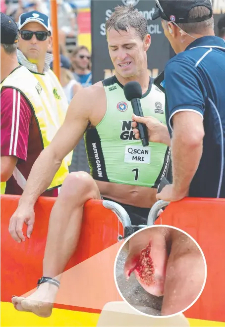  ?? Picture: HARVPIX.COM ?? Ouch! Shannon Eckstein shows off his injured toe after the opening race of Nutri-Grain ironman yesterday.