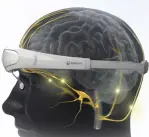  ?? (Courtesy) ?? NETANYA-BASED NEUROLIEF’S migraine band transmits electrical signals to stop migraine pain.