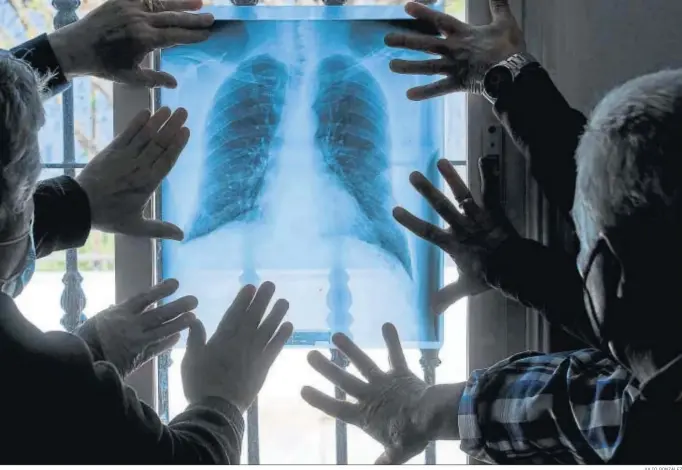  ?? JULIO GONZÁLEZ ?? Afectados por el amianto contemplan este viernes en San Fernando una radiografí­a en la que se observa los estragos que el material causa en los pulmones.