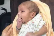  ?? HT PHOTO ?? The baby after surgery at Narayana hospital.