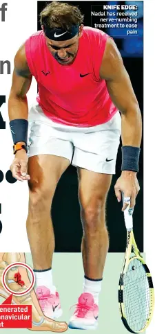  ?? ?? KNIFE EDGE: Nadal has received nerve-numbing treatment to ease pain