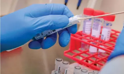  ?? Photograph: Ben Birchall/PA ?? A patient’s Covid-19 swab is taken out from a sterile tube. Scientists now now that UK epidemic was seeded by more than 1,000 distinct variants of the virus.