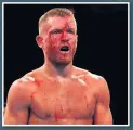  ??  ?? BLOODIED Flanagan after losing his unbeaten record on Saturday night