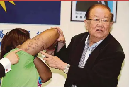  ?? PIC BY ZUNNUR AL SHAFIQ ?? MCA Public Services and Complaints Department head Datuk Seri Michael Chong showing Nanthini’s scars at Wisma MCA, Kuala Lumpur, yesterday.