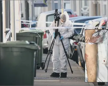  ??  ?? SHOOTING
Forensic teams at the scene and, inset, the leg injury sustained by the man