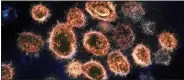  ?? NIAID-RML VIA AP ?? This 2020 electron microscope image shows SARS-CoV-2 virus particles which causes COVID-19.