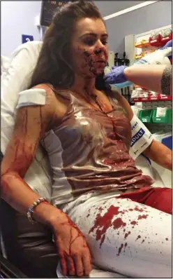  ??  ?? Horrific injuries: A blood-soaked Chloe Knapton in hospital