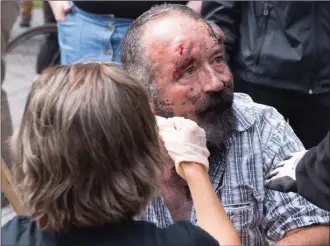  ?? The Canadian Press ?? Eric Roy receives medical attention after he was attacked by a group of people during an anti-racism demonstrat­ion Sunday in Quebec City.