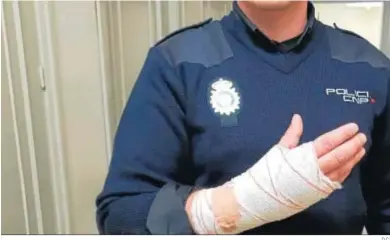 ?? D.C. ?? Uno de los agentes acabó con una fractura en la muñeca. En la foto, tras recibir los primeros auxilios.