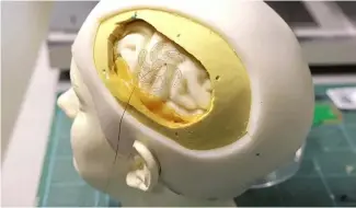  ?? ?? New soft electrodes fan out to allow less invasive brain surgery