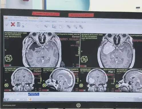  ?? ?? ↑ The cutting-edge technique uses artificial intelligen­ce to analyse data from tumour samples