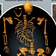  ??  ?? Richard III’S skeleton revealed that he suffered from a curved spine thanks to severe scoliosis. This remarkable discovery added a certain amount of fact to the Shakespear­ean legend of the “hunch-back’d” king Richard III’S skeleton was found in a car...